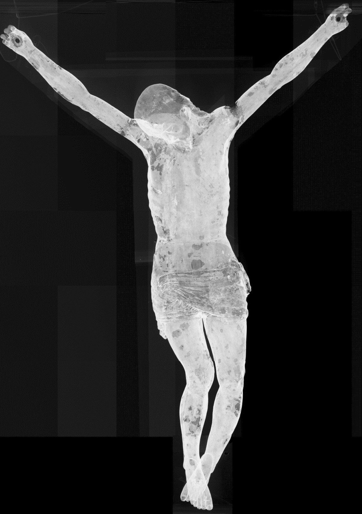 Estudio radiografico